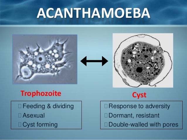 Acanthamoeba