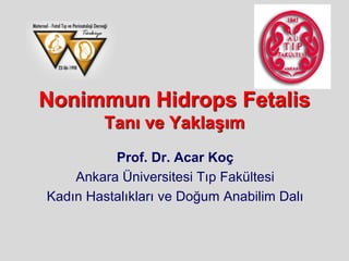 Nonimmun Hidrops Fetalis
Tanı ve Yaklaşım
Prof. Dr. Acar Koç
Ankara Üniversitesi Tıp Fakültesi
Kadın Hastalıkları ve Doğum Anabilim Dalı
 