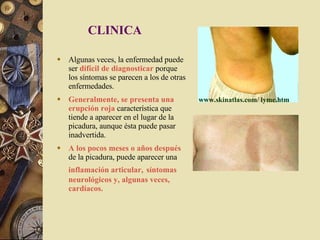 Algunas veces, la enfermedad puede ser  difícil de diagnosticar  porque los síntomas se parecen a los de otras enfermedades.  Generalmente, se presenta una erupción roja  característica que tiende a aparecer en el lugar de la picadura, aunque ésta puede pasar inadvertida.  A los pocos meses o años   después  de la picadura, puede aparecer una  inflamación articular,   síntomas neurológicos y, algunas veces, cardíacos. CLINICA www.skinatlas.com /  lyme.htm   