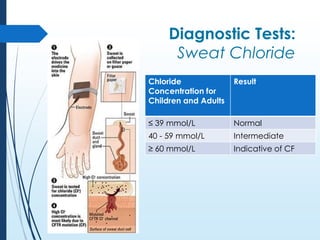 Cf Testing A case for cystic fibrosis | PPTX