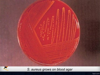 S. aureus grows on blood agar
 