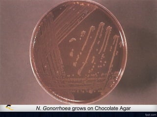 N. Gonorrhoea grows on Chocolate Agar
 