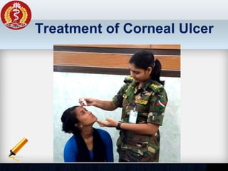 Treatment of Corneal Ulcer
 