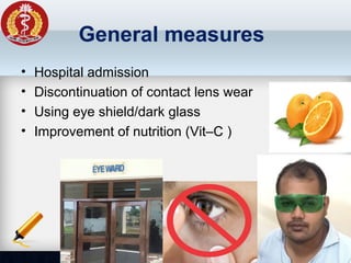General measures
• Hospital admission
• Discontinuation of contact lens wear
• Using eye shield/dark glass
• Improvement of nutrition (Vit–C )
 