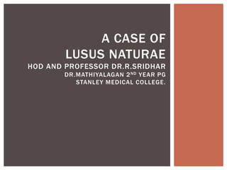 A CASE OF
LUSUS NATURAE
HOD AND PROFESSOR DR.R.SRIDHAR
DR.MATHIYALAGAN 2ND YEAR PG
STANLEY MEDICAL COLLEGE.
 