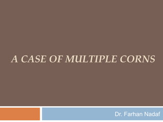 A CASE OF MULTIPLE CORNS

Dr. Farhan Nadaf

 