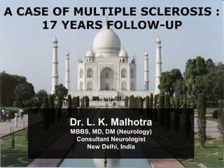 A CASE OF MULTIPLE SCLEROSIS :
17 YEARS FOLLOW-UP
Dr. L. K. Malhotra
MBBS, MD, DM (Neurology)
Consultant Neurologist
New Delhi, India
 