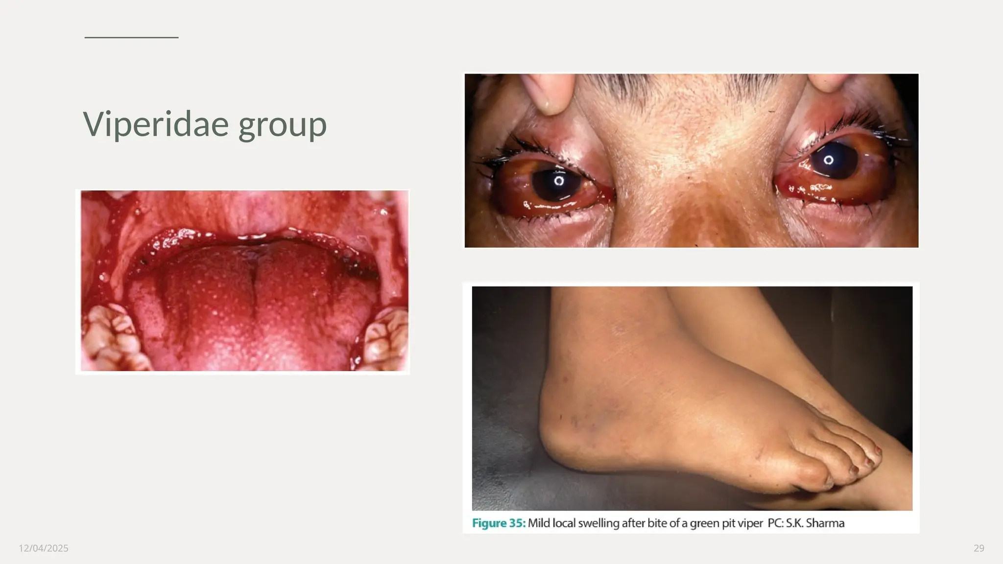 12/04/2025 29
Viperidae group
 