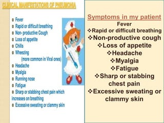 Symptoms in my patient
Fever
Rapid or difficult breathing
Non-productive cough
Loss of appetite
Headache
Myalgia
Fatigue
Sharp or stabbing
chest pain
Excessive sweating or
clammy skin
 