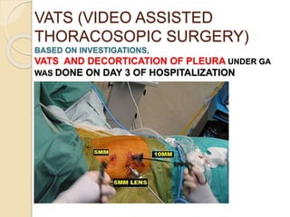 VATS (VIDEO ASSISTED
THORACOSOPIC SURGERY)
BASED ON INVESTIGATIONS,
VATS AND DECORTICATION OF PLEURA UNDER GA
WAS DONE ON DAY 3 OF HOSPITALIZATION
PICTURE
 