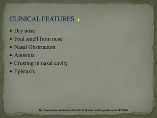 A case report -- Apeenasa/ Atrophic rhinitis-Shdabindu Taila Nasya ...
