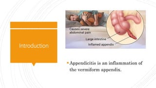 Introduction
Appendicitis is an inflammation of
the vermiform appendix.
 
