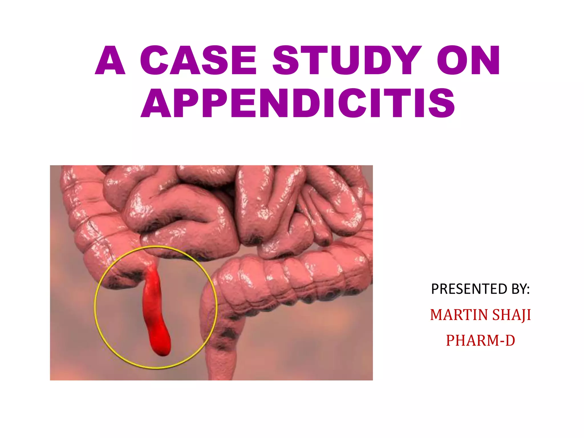 A case study on appendicitis / a case presentation on appendicitis PPT