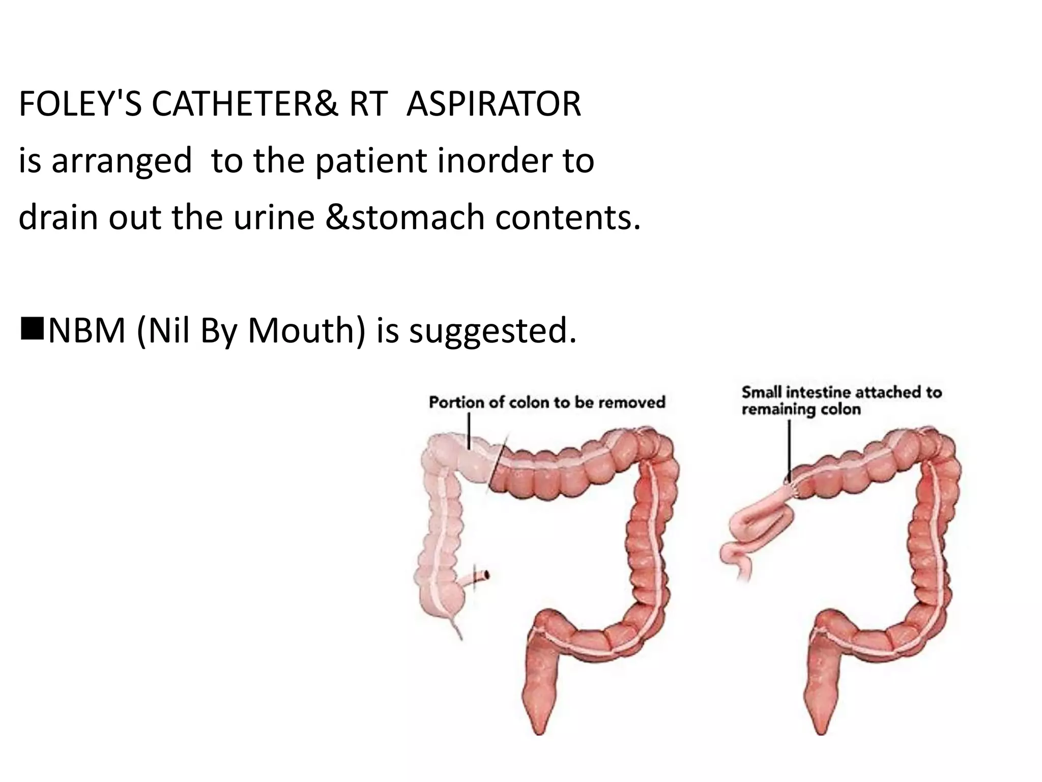 FOLEY'S CATHETER& RT ASPIRATOR
is arranged to the patient inorder to
drain out the urine &stomach contents.
NBM (Nil By Mouth) is suggested.
 