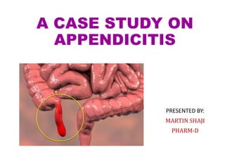 A CASE STUDY ON
APPENDICITIS
PRESENTED BY:
MARTIN SHAJI
PHARM-D
 