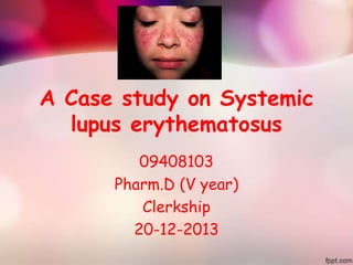 A Case study on Systemic
lupus erythematosus
09408103
Pharm.D (V year)
Clerkship
20-12-2013
 