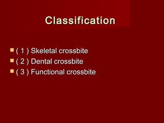 ClassificationClassification
 ( 1 ) Skeletal crossbite( 1 ) Skeletal crossbite
 ( 2 ) Dental crossbite( 2 ) Dental crossbite
 ( 3 ) Functional crossbite( 3 ) Functional crossbite
 