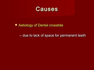  Aetiology of Dental crossbiteAetiology of Dental crossbite
– due to lack of space for permanent teethdue to lack of space for permanent teeth
CausesCauses
 