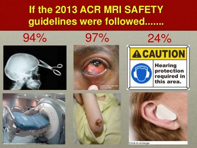 accident safety gun Gallery 2013 Mri Accidents Image