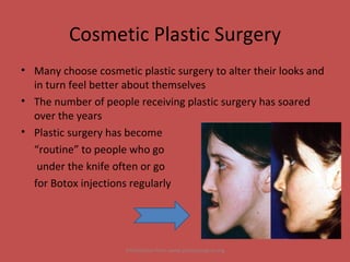 Cosmetic Plastic Surgery Many choose cosmetic plastic surgery to alter their looks and in turn feel better about themselves The number of people receiving plastic surgery has soared over the years Plastic surgery has become  “ routine” to people who go  under the knife often or go  for Botox injections regularly Information from www.plasticsurgery.org 