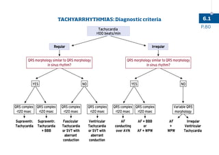 QRS morphology similar to QRS morphology
in sinus rhythm?
QRS morphology similar to QRS morphology
in sinus rhythm?
YES
QRS complex
120 msec
Supraventr.
Tachycardia
QRS complex
120 msec
Supraventr.
Tachycardia
+ BBB
QRS complex
120 msec
QRS complex
120 msec
Fascicular
Tachycardia
or SVT with
aberrant
conduction
Ventricular
Tachycardia
or SVT with
aberrant
conduction
QRS complex
120 msec
QRS complex
120 msec
AF
conducting
over AVN
AF + BBB
or
AF + WPW
AF
+
WPW
Irregular
Ventricular
Tachycardia
Variable QRS
morphology
NO YES NO
TACHYARRHYTHMIAS: DIAGNOSTIC CRITERIA
Tachycardia
100 beats/min
Irregular
Regular
P.80
6.1
TACHYARRHYTHMIAS: Diagnostic criteria
 