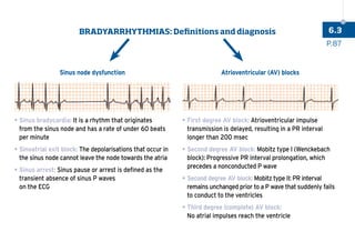 Sinus node dysfunction Atrioventricular (AV) blocks
•	Sinus bradycardia: It is a rhythm that originates
from the sinus node and has a rate of under 60 beats
per minute
•	
Sinoatrial exit block: The depolarisations that occur in
the sinus node cannot leave the node towards the atria
•	Sinus arrest: Sinus pause or arrest is defined as the
transient absence of sinus P waves
on the ECG
•	
First degree AV block: Atrioventricular impulse
transmission is delayed, resulting in a PR interval
longer than 200 msec
•	
Second degree AV block: Mobitz type I (Wenckebach
block): Progressive PR interval prolongation, which
precedes a nonconducted P wave
•	
Second degree AV block: Mobitz type II: PR interval
remains unchanged prior to a P wave that suddenly fails
to conduct to the ventricles
•	
Third degree (complete) AV block:
No atrial impulses reach the ventricle
P.87
6.3
BRADYARRHYTHMIAS: Definitions and diagnosis
 