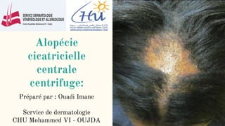 Alopécie
cicatricielle
centrale
centrifuge:
Préparé par : Ouadi Imane
Service de dermatologie
CHU Mohammed VI - OUJDA
 