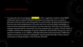 107
MODIFIED TECHNIQUE
• To reduce the risk of root damage, Jorge et al in 2013, suggested a method, called MIRO
(Minimally Invasive Rapid Orthodontic procedure) by using metal wire as a guide to
placement of the incisions, and subsequently the corticotomies. He placed metal guides in
between each tooth, perpendicular to the main arch wire, and took digital radiographs, to
ensure that the metal guides did not project over the tooth roots. Once this was confirmed,
incisions and piezoelectric corticotomy was done using the pins as a guide. Clinical results of
a MIRO, maintains the advantages of speedy orthodontics described by Chung et al., but is a
much less traumatic, as it is flapless, reducing both trauma and convalescence. MIRO also
enhances accuracy by relying on radiographic surgical guides that help to make a precise
corticotomy avoiding damage to vital structures and teeth.
 