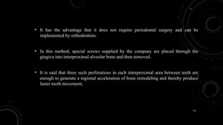 111
• It has the advantage that it does not require periodontal surgery and can be
implemented by orthodontists.
• In this method, special screws supplied by the company are placed through the
gingiva into interproximal alveolar bone and then removed.
• It is said that three such perforations in each interproximal area between teeth are
enough to generate a regional acceleration of bone remodeling and thereby produce
faster tooth movement.
 