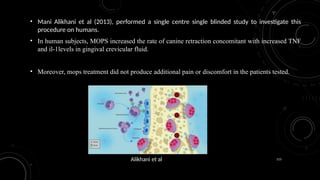115
• Mani Alikhani et al (2013), performed a single centre single blinded study to investigate this
procedure on humans.
• In human subjects, MOPS increased the rate of canine retraction concomitant with increased TNF
and il-1levels in gingival crevicular fluid.
• Moreover, mops treatment did not produce additional pain or discomfort in the patients tested.
Alikhani et al
 