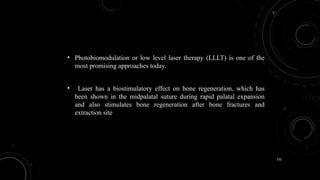 132
• Photobiomodulation or low level laser therapy (LLLT) is one of the
most promising approaches today.
• Laser has a biostimulatory effect on bone regeneration, which has
been shown in the midpalatal suture during rapid palatal expansion
and also stimulates bone regeneration after bone fractures and
extraction site
 