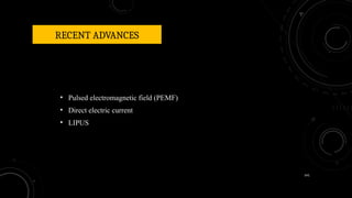 141
RECENT ADVANCES
• Pulsed electromagnetic field (PEMF)
• Direct electric current
• LIPUS
 