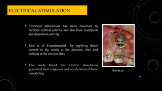 ELECTRICAL STIMULATION
• Electrical stimulation has been observed to
increase cellular activity and also bone resorption
and deposition activity
• Kim et al. Experimented by applying direct
current to the anode at the pressure sites and
cathode at the tension sites
• This study found that electric stimulation
generated local responses and acceleration of bone
remodeling
144
Kim et al
 