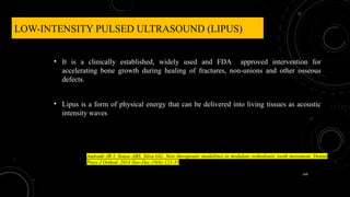 149
LOW-INTENSITY PULSED ULTRASOUND (LIPUS)
• It is a clinically established, widely used and FDA approved intervention for
accelerating bone growth during healing of fractures, non-unions and other osseous
defects.
• Lipus is a form of physical energy that can be delivered into living tissues as acoustic
intensity waves
Andrade JR I, Sousa ABS, Silva GG. New therapeutic modalities to modulate orthodontic tooth movement. Dental
Press J Orthod. 2014 Nov-Dec;19(6):123-33
 