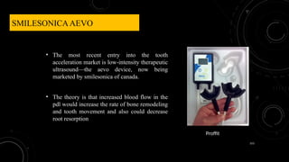 153
SMILESONICAAEVO
• The most recent entry into the tooth
acceleration market is low-intensity therapeutic
ultrasound—the aevo device, now being
marketed by smilesonica of canada.
• The theory is that increased blood flow in the
pdl would increase the rate of bone remodeling
and tooth movement and also could decrease
root resorption
Proffit
 