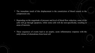 19
• The immediate result of this displacement is the constriction of blood vessels in the
compression site.
• Depending on the magnitude of pressure and level of blood flow reduction, some of the
cells will go through apoptosis, while some cells will die non-specifically, resulting in
areas of necrosis.
• These sequences of events lead to an aseptic, acute inflammatory response with the
early release of chemokines from local cell
 