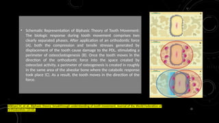 22
• Schematic Representation of Biphasic Theory of Tooth Movement:
The biologic response during tooth movement comprises two
clearly separated phases. After application of an orthodontic force
(A), both the compression and tensile stresses generated by
displacement of the tooth cause damage to the PDL, stimulating a
perimeter of osteoclastogenesis (B). Once the tooth moves in the
direction of the orthodontic force into the space created by
osteoclast activity, a perimeter of osteogenesis is created in roughly
in the same area of the alveolar bone where the catabolic response
took place (C). As a result, the tooth moves in the direction of the
force.
Alikhani M, et al., Biphasic theory: breakthrough understanding of tooth movement, Journal of the World Federation of
Orthodontists (2018),
 