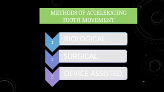 24
METHODS OF ACCELERATING
TOOTH MOVEMENT
1 BIOLOGICAL
2 SURGICAL
3 DEVICE ASSISTED
 