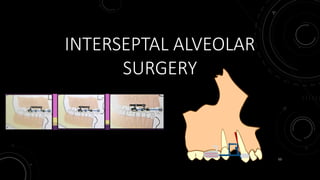53
INTERSEPTAL ALVEOLAR
SURGERY
 