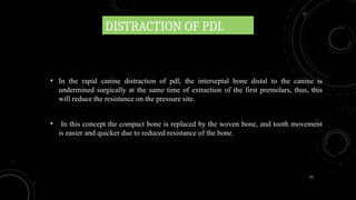 55
DISTRACTION OF PDL
• In the rapid canine distraction of pdl, the interseptal bone distal to the canine is
undermined surgically at the same time of extraction of the first premolars, thus, this
will reduce the resistance on the pressure site.
• In this concept the compact bone is replaced by the woven bone, and tooth movement
is easier and quicker due to reduced resistance of the bone.
 