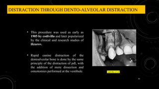60
DISTRACTION THROUGH DENTO-ALVEOLAR DISTRACTION
• This procedure was used as early as
1905 by codivilla and later popularized
by the clinical and research studies of
ilizarov.
• Rapid canine distraction of the
dentoalveolar bone is done by the same
principle of the distraction of pdl, with
the addition of more dissection and
osteotomies performed at the vestibule. sukrika et al
 