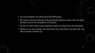 69
• No root resorption was observed in the DAD group.
• Six canines showed widening of the periodontal ligament space at the root apex,
but there was no root resorption in 21 canines.
• No loss of tooth vitality in any maxillary canine was observed in the dad group.
• Moreover, no color change was observed in any teeth before and after dad, and
after 6 months of follow-up.
 