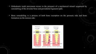 7
• Orthodontic tooth movement occurs in the presence of a mechanical stimuli sequenced by
remodelling of the alveolar bone and periodontal ligament (pdl).
• Bone remodelling is a process of both bone resorption on the pressure side and bone
formation on the tension side.
 