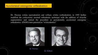 79
Accelerated osteogenic orthodontics
Dr. Thomas wilcko (periodontist) and william wilcko (orthodontist), in 1995 further
modified the corticotomy assisted orthodontic technique with the addition of alveolar
augmentation and named the procedure as periodontally accelerated osteogenic
orthodontics (PAOO) later patented as “wilckodontics”
Dr. Thomas
Dr. William
 