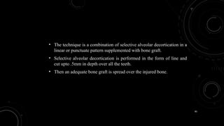 80
• The technique is a combination of selective alveolar decortication in a
linear or punctuate pattern supplemented with bone graft.
• Selective alveolar decortication is performed in the form of line and
cut upto .5mm in depth over all the teeth.
• Then an adequate bone graft is spread over the injured bone.
 