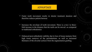 89
ADVANTAGE
• Faster tooth movement results in shorter treatment duration and
therefore reduces patient burnout
• Increases the envelope of tooth movement. There is a two- to three-
fold increase in the distance that the teeth can be moved as compared
to traditional orthodontics
• Enhanced post-orthodontic stability due to loss of tissue memory from
high tissue turnover of the periodontium, as well as increased
thickness of the alveolar cortices from the augmentation grafting.
 