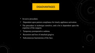 90
DISADVANTAGES
• Invasive procedure.
• Dependent upon patient compliance for timely appliance activation.
• The procedure is technique sensitive, and a lot is dependent upon the
expertise of the surgeon.
• Temporary postoperative oedema.
• Recession and loss of attached gingiva.
• Subcutaneous haematoma of the face.
 