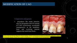 91
MODIFICATION OF CAO
Compression osteogenesis
• procedures like molar intrusion
may be designated with CO instead
of CAO (corticotomy accelerated
osteogenesis), as the medullary
bone and overlying mucosa
supports the tooth bone block .
Oliveira, Dauro & Oliveira, Bruno & V Soares, Rodrigo. (2010). Corticotomias alveolares na Ortodontia: indicações e efeitos na
movimentação dentária. Dental Press Journal of Orthodontics. 15. 10.1590/S2176-94512010000400019.
 