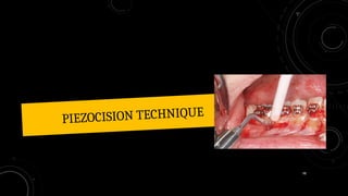 98
PIEZOCISION TECHNIQUE
 