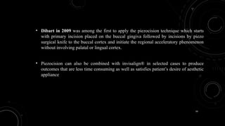 99
• Dibart in 2009 was among the first to apply the piezocision technique which starts
with primary incision placed on the buccal gingiva followed by incisions by piezo
surgical knife to the buccal cortex and initiate the regional acceleratory phenomenon
without involving palatal or lingual cortex.
• Piezocision can also be combined with invisalign® in selected cases to produce
outcomes that are less time consuming as well as satisfies patient’s desire of aesthetic
appliance
 